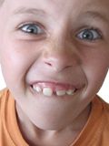Junge mit Zahnlücken